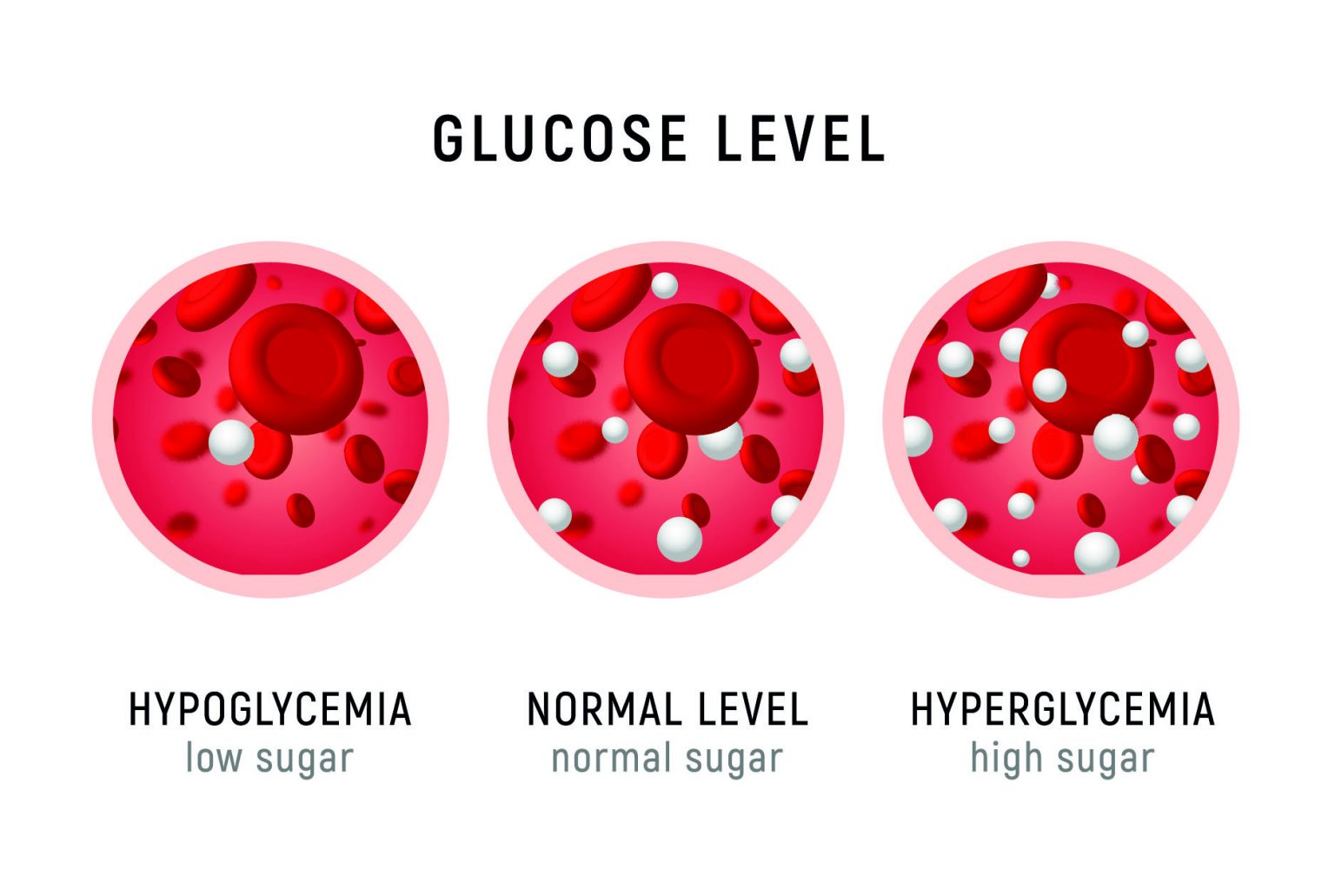 What Is Low Blood Sugar?